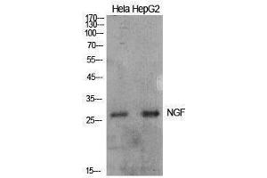 Western Blotting (WB) image for anti-Nerve Growth Factor (NGF) (Internal Region) antibody (ABIN3181419) (Nerve Growth Factor 抗体  (Internal Region))