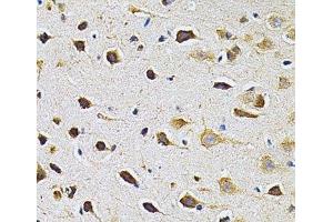 Immunohistochemistry of paraffin-embedded Rat brain using ADRBK1 Polyclonal Antibody at dilution of 1:200 (40x lens). (GRK2 抗体)