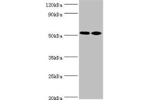 Western blot All lanes: Annexin A7 antibody at 4 μg/mL Lane 1: Jurkat whole cell lysate Lane 2: LO2 whole cell lysate Secondary Goat polyclonal to rabbit at 1/10000 dilution Predicted band size: 53, 51 kDa Observed band size: 53 kDa (Annexin VII 抗体  (AA 259-488))