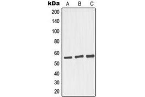 Western blot analysis of GRASP55 expression in HepG2 (A), Raji (B), LOVO (C) whole cell lysates. (GORASP2 抗体  (Center))