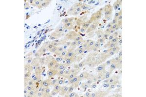 Immunohistochemistry of paraffin-embedded human liver using RGS5 antibody (ABIN6130676, ABIN6146924, ABIN6146925 and ABIN6222790) at dilution of 1:100 (40x lens). (RGS5 抗体  (AA 1-181))