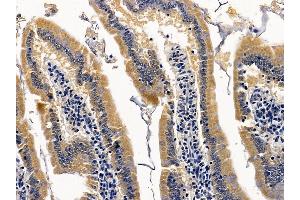 ABIN6264355 and ABIN6278163 at 1/100 staining rat colorectal tissue by IHC-P.