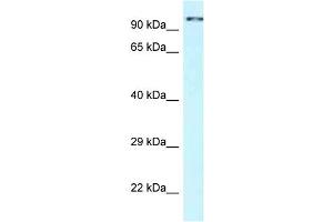 WB Suggested Anti-CDK11A Antibody Titration: 1. (Cyclin-Dependent Kinase 11A (CDK11A) (C-Term) 抗体)