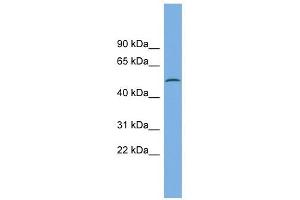 CAMK1G antibody used at 1 ug/ml to detect target protein. (CAMK1G 抗体  (N-Term))