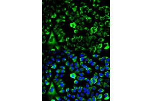 Immunofluorescence analysis of HeLa cells using RPS3 antibody (ABIN6290898). (RPS3 抗体)
