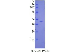 SDS-PAGE analysis of Mouse IL17RC Protein. (IL17RC 蛋白)