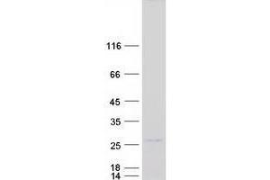 Western Blotting (WB) image for Zinc Finger Protein 740 (ZNF740) protein (Myc-DYKDDDDK Tag) (ABIN2736116)