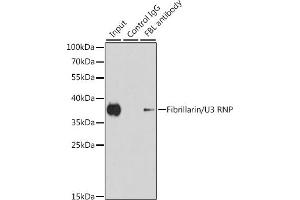 Immunoprecipitation analysis of 200 μg extracts of HeLa cells using 1 μg Fibrillarin/U3 RNP antibody . (Fibrillarin 抗体)
