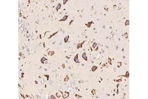 Immunohistochemistry analysis of paraffin-embedded mouse cerebellum using,Chrnb1 (ABIN7074841) at dilution of 1: 2000 (CHRNB1 抗体)