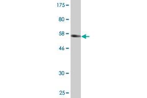 Western Blot detection against Immunogen (62.