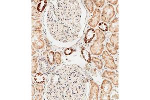 Immunohistochemical analysis of paraffin-embedded human kidney tissue using D performed on the Leica® BOND RXm. (GLS2 抗体  (AA 498-524))