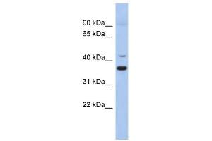 GADL1 antibody used at 1 ug/ml to detect target protein. (GADL1 抗体  (Middle Region))