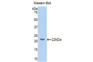 Western Blotting (WB) image for anti-Z-DNA Binding Protein 1 (ZBP1) (AA 10-167) antibody (ABIN1860971) (ZBP1 抗体  (AA 10-167))