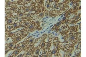IHC-P analysis of Human Liver Tissue, with DAB staining. (DIXDC1 抗体  (AA 485-683))