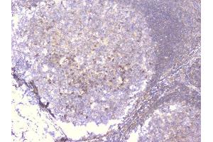 IHC analysis of PCDH15 using anti-PCDH15 antibody (ABIN6719362).