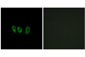 Immunofluorescence analysis of A549 cells, using CSTL1 antibody. (CSTL1 抗体  (Internal Region))