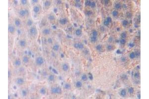 Used in DAB staining on fromalin fixed paraffin- embedded kidney tissue (Kallikrein 1 抗体  (AA 21-261))