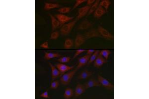 Immunofluorescence (IF) image for anti-3-phosphoinositide Dependent Protein Kinase-1 (PDPK1) (AA 1-150) antibody (ABIN5663787)