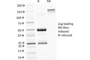 SDS-PAGE Analysis Purified ASRGL1 Mouse Monoclonal Antibody (CRASH/1289). (ASRGL1 抗体)