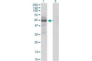 Western Blot analysis of PLTP expression in transfected 293T cell line by PLTP monoclonal antibody (M01), clone 2F3-G4. (PLTP 抗体  (AA 19-441))