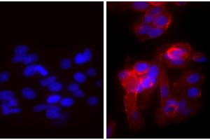 Human epithelial carcinoma cell line HEp-2 was stained with Mouse Anti-Human CD44-UNLB and DAPI. (山羊 anti-小鼠 IgG (Heavy & Light Chain) Antibody (TRITC))
