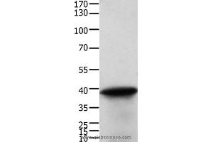 Western blot analysis of Human cervical cancer tissue, using TPM2 Polyclonal Antibody at dilution of 1:600 (TPM2 抗体)