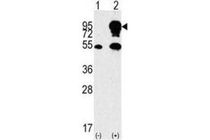 Western Blotting (WB) image for anti-Small Nuclear Ribonucleoprotein Polypeptide E (SNRPE) antibody (ABIN3003507) (SNRPE 抗体)