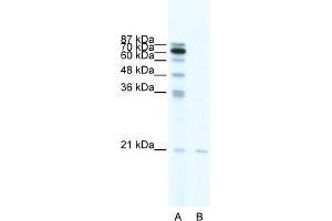 WB Suggested Anti-SCAND1 Antibody Titration:  0. (SCAND1 抗体  (Middle Region))