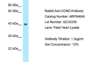 Western Blotting (WB) image for anti-Cyclin O (CCNO) (N-Term) antibody (ABIN2789909)