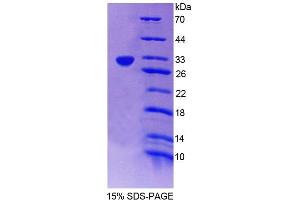SDS-PAGE (SDS) image for Nuclear Receptor Subfamily 1, Group I, Member 3 (NR1I3) (AA 1-247) protein (His tag) (ABIN6239089)