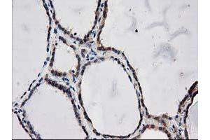 Image no. 15 for anti-ADP-Ribosylation Factor GTPase Activating Protein 1 (ARFGAP1) antibody (ABIN1496679)