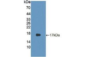 Figure. (CDKN2B 抗体  (AA 1-130))