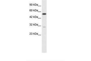 Image no. 1 for anti-Hepatocyte Nuclear Factor 4 gamma (HNF4G) (C-Term) antibody (ABIN6735846) (HNF4 gamma 抗体  (C-Term))