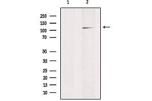 Western blot analysis of extracts from HepG2, using RANBP17 Antibody. (RANBP17 抗体  (N-Term))