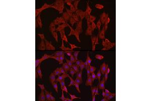 Immunofluorescence analysis of PC-12 cells using [KO Validated] Caspase-3 Rabbit pAb (ABIN6134639, ABIN6137978, ABIN6137979 and ABIN6215159) at dilution of 1:300 (40x lens). (Caspase 3 抗体  (AA 1-100))