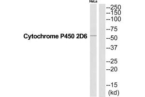 Western Blotting (WB) image for anti-Cytochrome P450, Family 2, Subfamily D, Polypeptide 6 (CYP2D6) (Internal Region) antibody (ABIN1852662) (CYP2D6 抗体  (Internal Region))