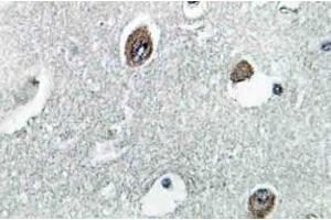 Immunohistochemistry (IHC) analyzes of NDUFB10 antibody in paraffin-embedded human brain tissue. (NDUFB10 抗体)
