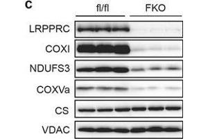 Western Blotting (WB) image for anti-Citrate Synthase (CS) antibody (ABIN2856769)