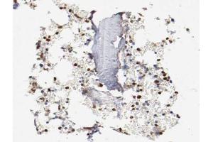 ABIN6266478 at 1/200 staining human Bone marrow tissue sections by IHC-P. (CEBPE 抗体  (Internal Region))