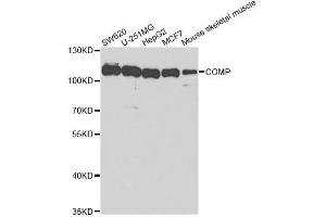 Western blot analysis of extracts of various cell lines, using COMP antibody. (COMP 抗体  (AA 20-160))