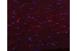 IF analysis of CAV3 using anti-CAV3 antibody (ABIN6719285).