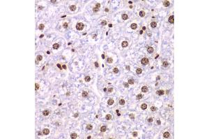 Immunohistochemistry of paraffin-embedded mouse liver using SSRP1 antibody (ABIN5973814) at dilution of 1/200 (40x lens). (SSRP1 抗体)