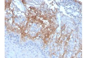 Formalin-fixed, paraffin-embedded human Skin stained with Decorin Mouse Monoclonal Antibody (DCN/3523). (Decorin 抗体  (AA 212-336))