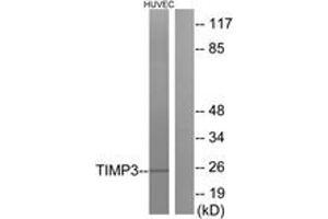 Western blot analysis of extracts from HuvEc cells, using TIMP3 Antibody. (TIMP3 抗体  (AA 91-140))