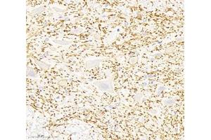 Immunohistochemistry analysis of paraffin-embedded rat spinal cord using,KCC2 (ABIN7075650) at dilution of 1: 1800 (KCC2 抗体)