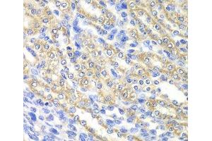 Immunohistochemistry of paraffin-embedded Rat kidney using SURF1 Polyclonal Antibody at dilution of 1:100 (40x lens). (SURF1 抗体)