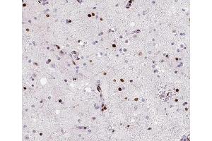 ABIN6266714 at 1/100 staining human brain tissue sections by IHC-P. (MED14 抗体  (Internal Region))