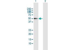 Western Blot analysis of MMP12 expression in transfected 293T cell line by MMP12 MaxPab polyclonal antibody. (MMP12 抗体  (AA 1-470))