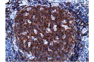 Immunohistochemistry (IHC) image for anti-phosphoinositide-3-Kinase Adaptor Protein 1 (PIK3AP1) antibody (ABIN1496822) (PIK3AP1 抗体)