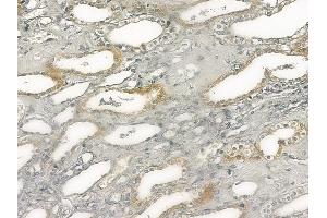 ABIN6263850 and ABIN6272719 at 1/100 staining human normal kidney tissue by IHC-P.